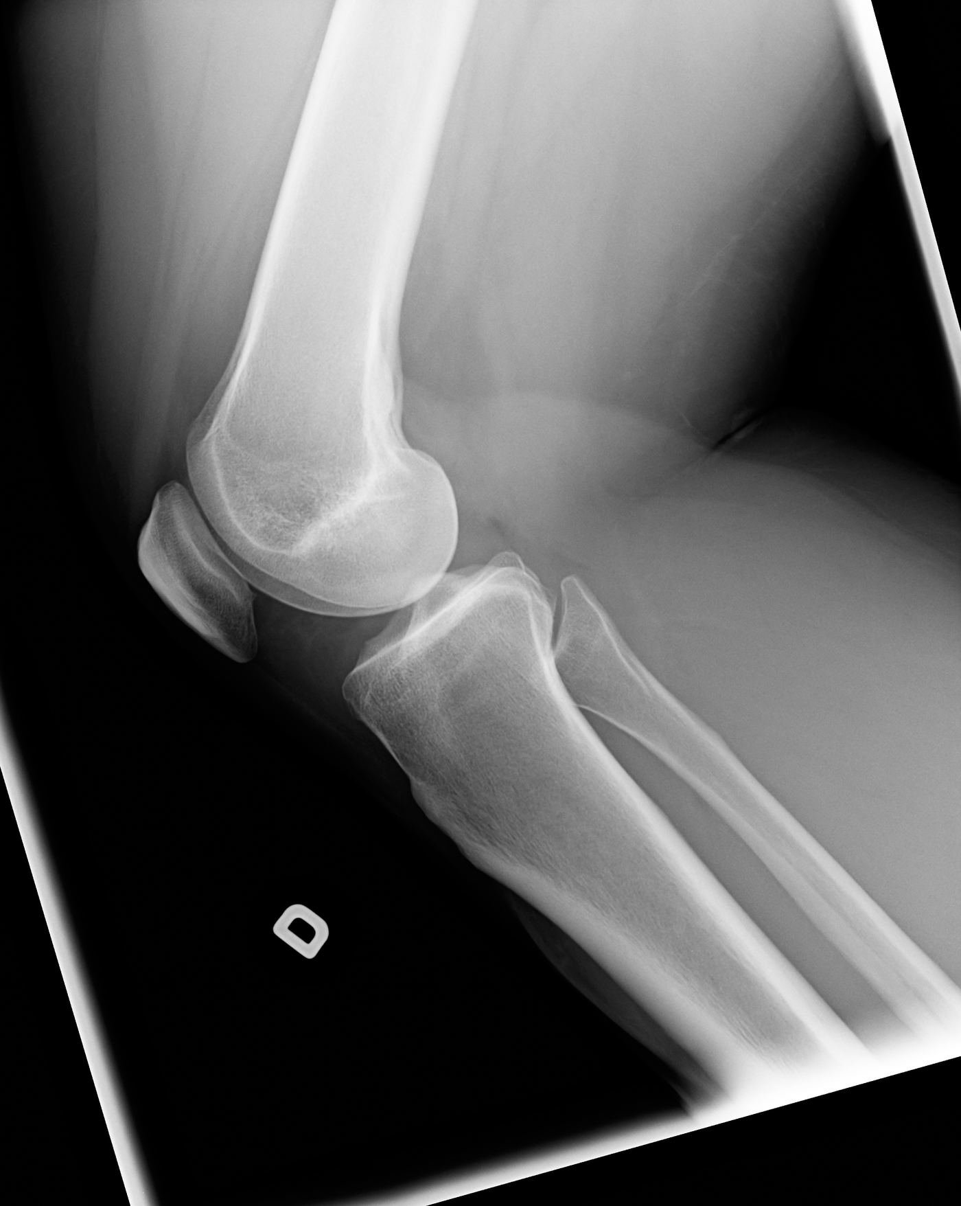 Diagnostic imaging used to guide regenerative treatment
